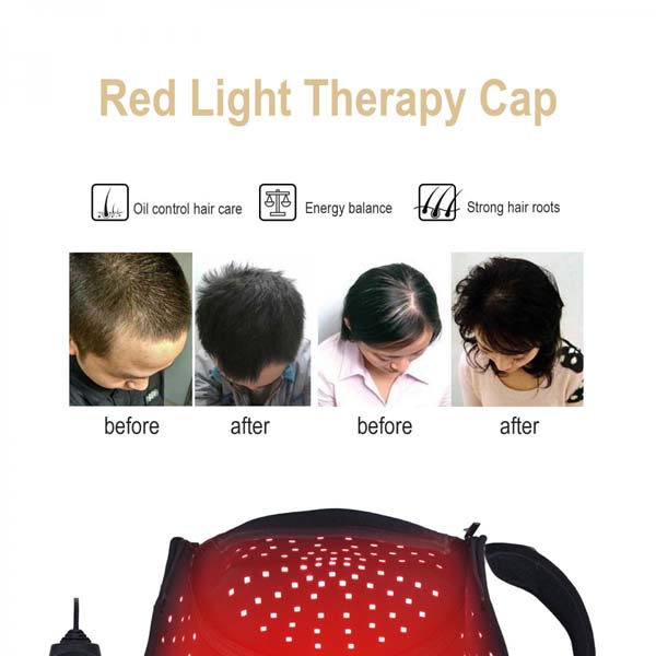 Freyara - Red Light & Near Infrared Light Therapy Cap 216 LEDs Freyara - Red Light & Near Infrared Light Therapy Cap 216 LEDs