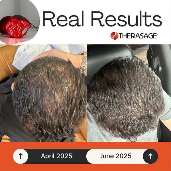 Therasage - TheraCap Red Light & Infrared Light Therapy Hat